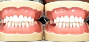 Fogászat tömés Budapest